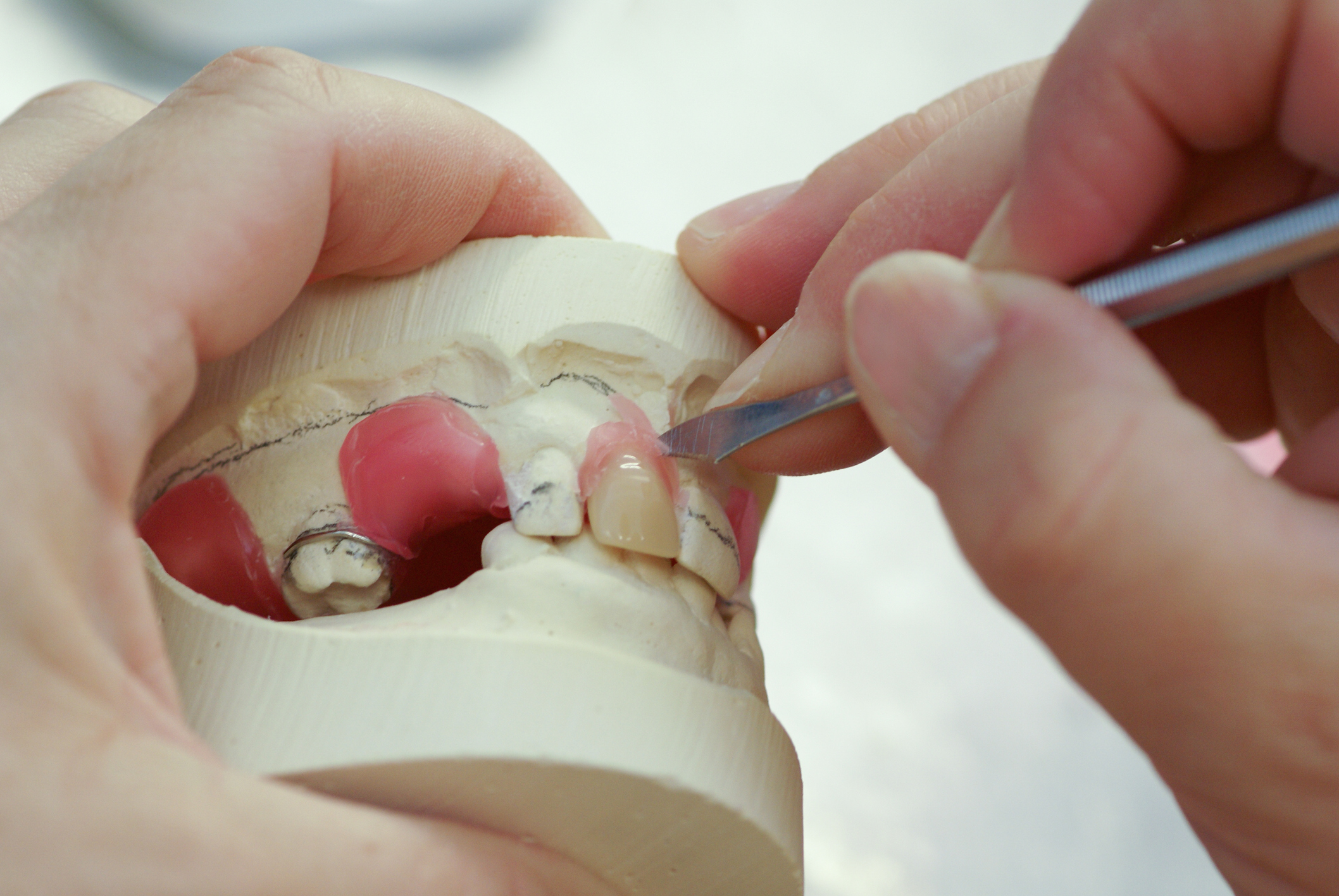 Dentures What Are False Teeth Made Out Of Catonsville Dental Care