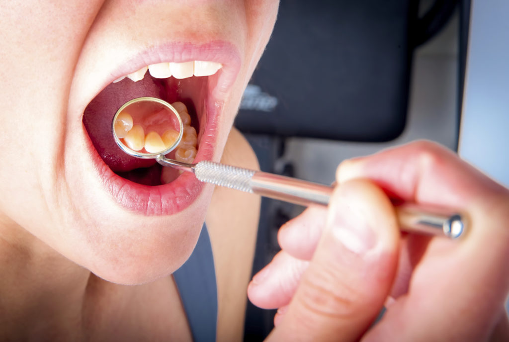 is-gum-disease-curable-catonsville-dental-care