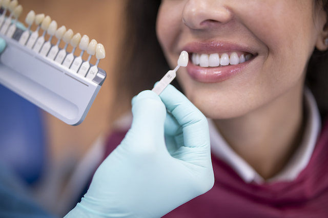 The Finest Strategies for Tooth Whitening