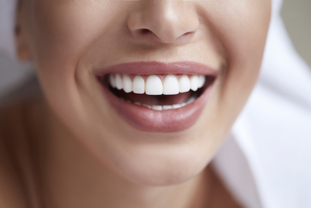 The Magic of Our Enamel Whitening Process